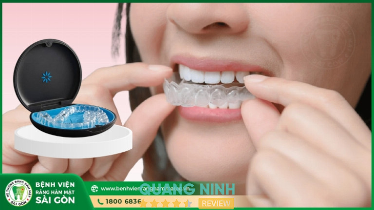 Niềng răng tại Bệnh Viện Răng Hàm Mặt Sài Gòn